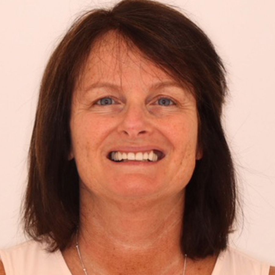 Elaine Collins - after white fillings treatment - 3Dental